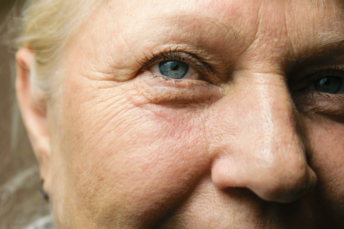 common-eye-diseases-vision-loss-resources